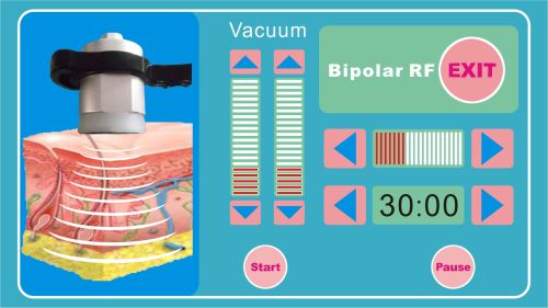 Máquina de radiofrecuencia por cavitación ultrasónica de vacío por RF portátil profesional