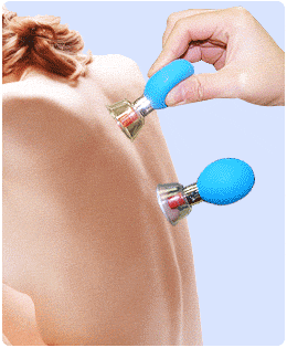HACI Suction Cupping Set - 8 Cups Silver Plated