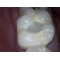 MD750+MD360  camera   dental intraoral camera
