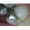 MD970 AV camera   VIDEO dental intraoral camera