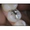 MD9503O  3.0M dental  camera   dental intraoral camera