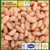 400g*24 canned white kidney beans