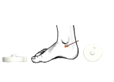 Foot Pulse Patch for diabetes Prediction