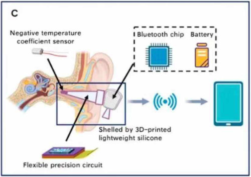 Ear Canal Implanted human core body temperature thermometer