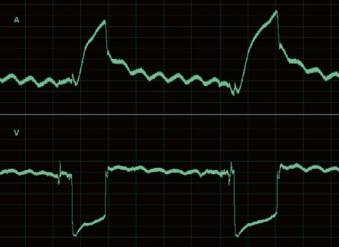 What is Pulse MIG?