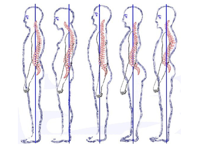 Improve Posture and Balance