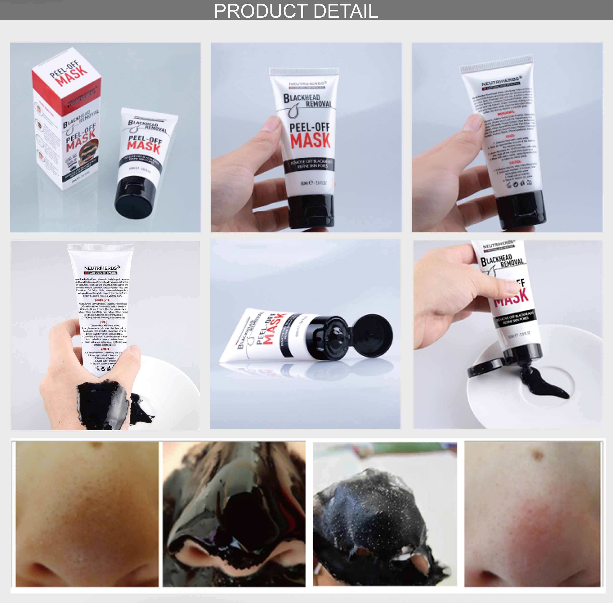 blackheads and whiteheads removal-blackhead maske-blackhead cleanser-products for blackheads