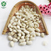 Wholesale White Kidney Beans Of Xinjiang GOODLUCK At Low Price