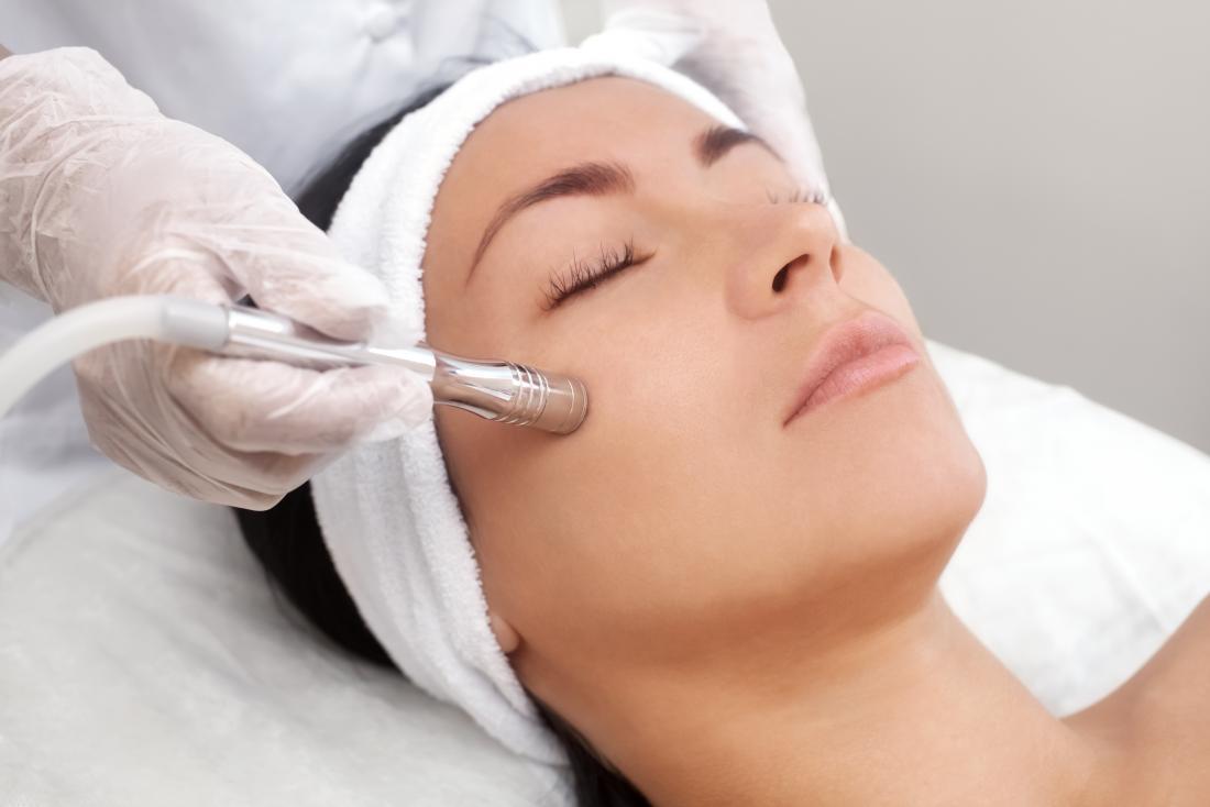 How Microdermabrasion works？