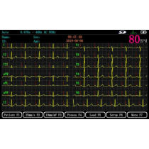Basic Economical Digital 3 Three Channel Electrocardiograph ECG Machine