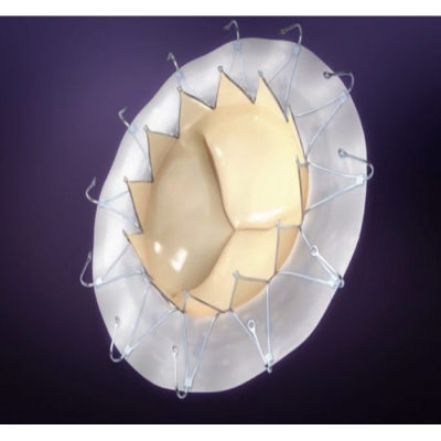 AccuFit® Transapical Mitral Valve Replacement System