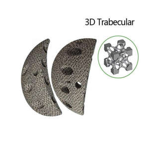 Orthopedic prosthesis 3D printing trabecular acetabular cup with high quality
