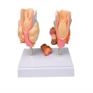 Human Larynx Anatomical Model Thyroid Pathological Model, human pharyngeal pathology detachable throat anatomical model