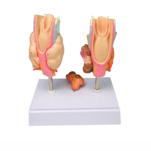 Human Larynx Anatomical Model Thyroid Pathological Model, human pharyngeal pathology detachable throat anatomical model