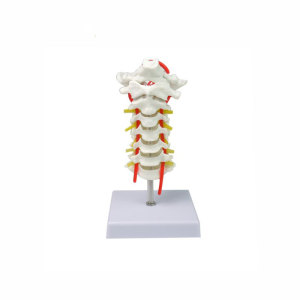 Cervical vertebra carotid artery, occipital, intervertebral disc and nerve skeleton model, cervical spinal column