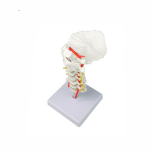 Cervical vertebra carotid artery, occipital, intervertebral disc and nerve skeleton model, cervical spinal column