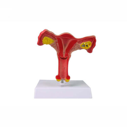 Anatomic model of female reproductive organ uterine and ovary reproductive structure model gynecological model