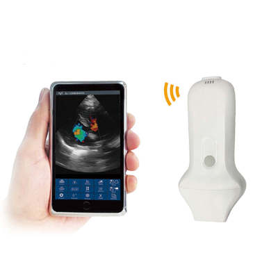 Unique Mini Wifi Portable 128 Elements Color Doppler Phased Array Cardiac Probe Wireless Ultrasound Scanner