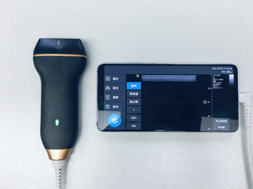 New Style Linear Probe Portable Handheld USB Ultrasound For Android Device