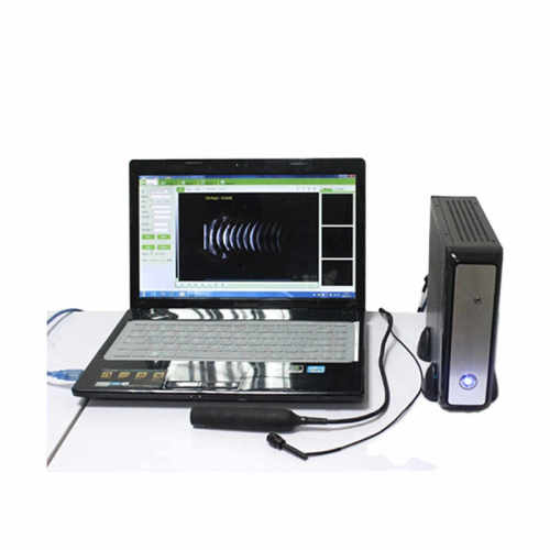 High Quality medical Ophthalmic A/B ultrasound box scanner with CE Certificate
