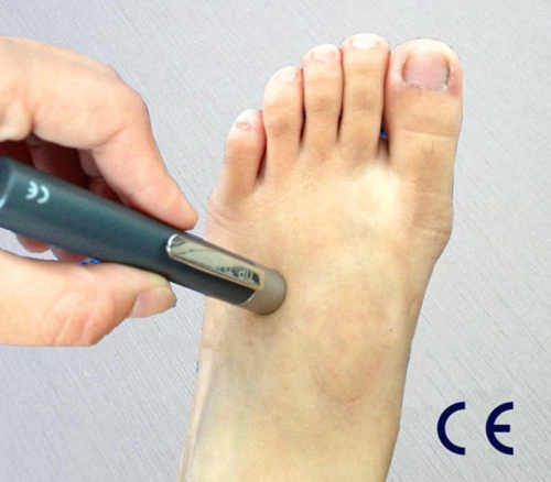 Diabetic Foot Neuropathy Analyser Diabetes Blood Test Equipment Neuro Tip Therm