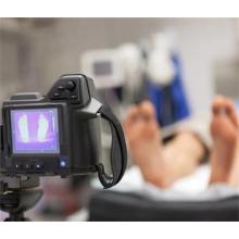 The Application of Infrared Thermal Imaging Technology in Medical Industry