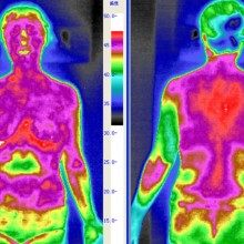 The Advantages of Infrared Thermal Imaging Technology in the Medical Field