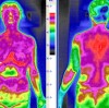 The Advantages of Infrared Thermal Imaging Technology in the Medical Field