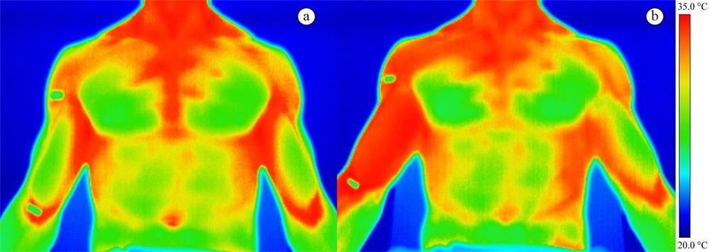 the application of infrared thermal imaging technology in the medical field