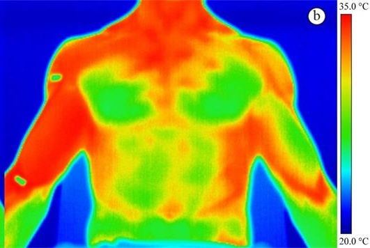 What Are the Applications of Infrared Thermal Imaging Technology in the Medical Field?