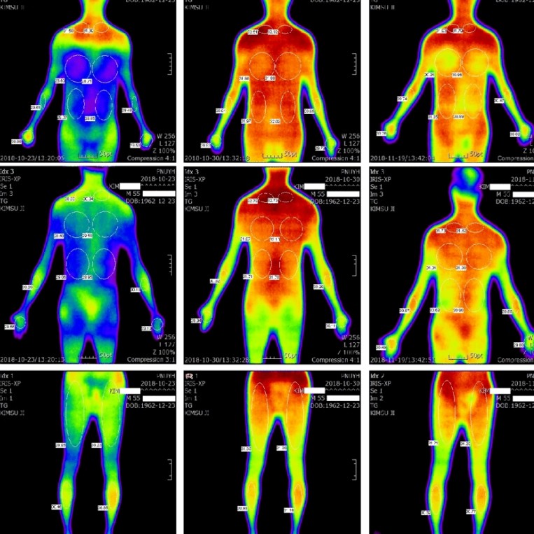 Thermal Imaging: An Innovative Technology Driving Our Everyday Uses