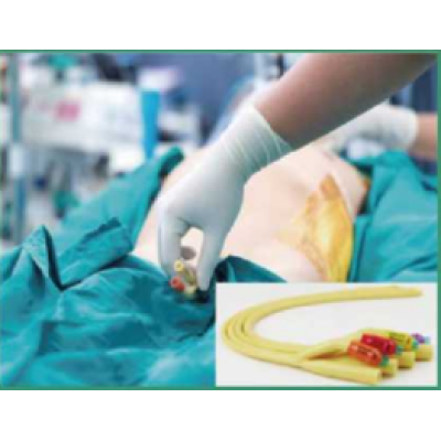 Disposable Urinary Catheter Kit/Urinary Bag
