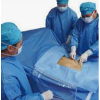 OEM Disposable Surgical Drapes Medical Drape Pack