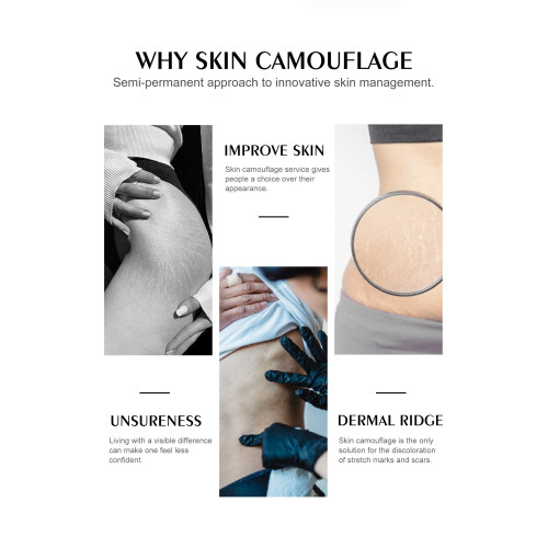 "Unleashing the Potential of the SKIN Camouflage Market: Perfect Coverage, Confidence, and Growth"