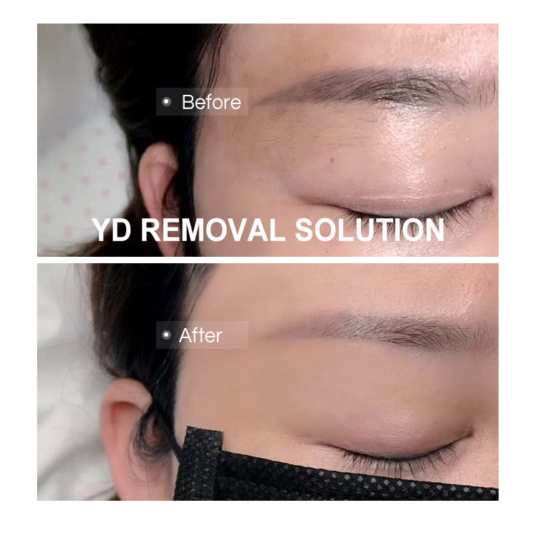 permanent makeup removal solution