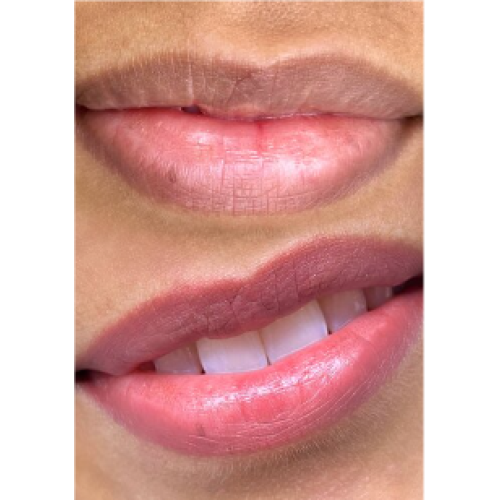 Achieve Radiant Lips with Dark Lip Neutralization: A Complete Guide