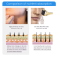 Facial Microneedle Roller Massage DRS 540 Derma Roller Needle Instrument Face Roller Massager Needles Skin Care Tool for Face