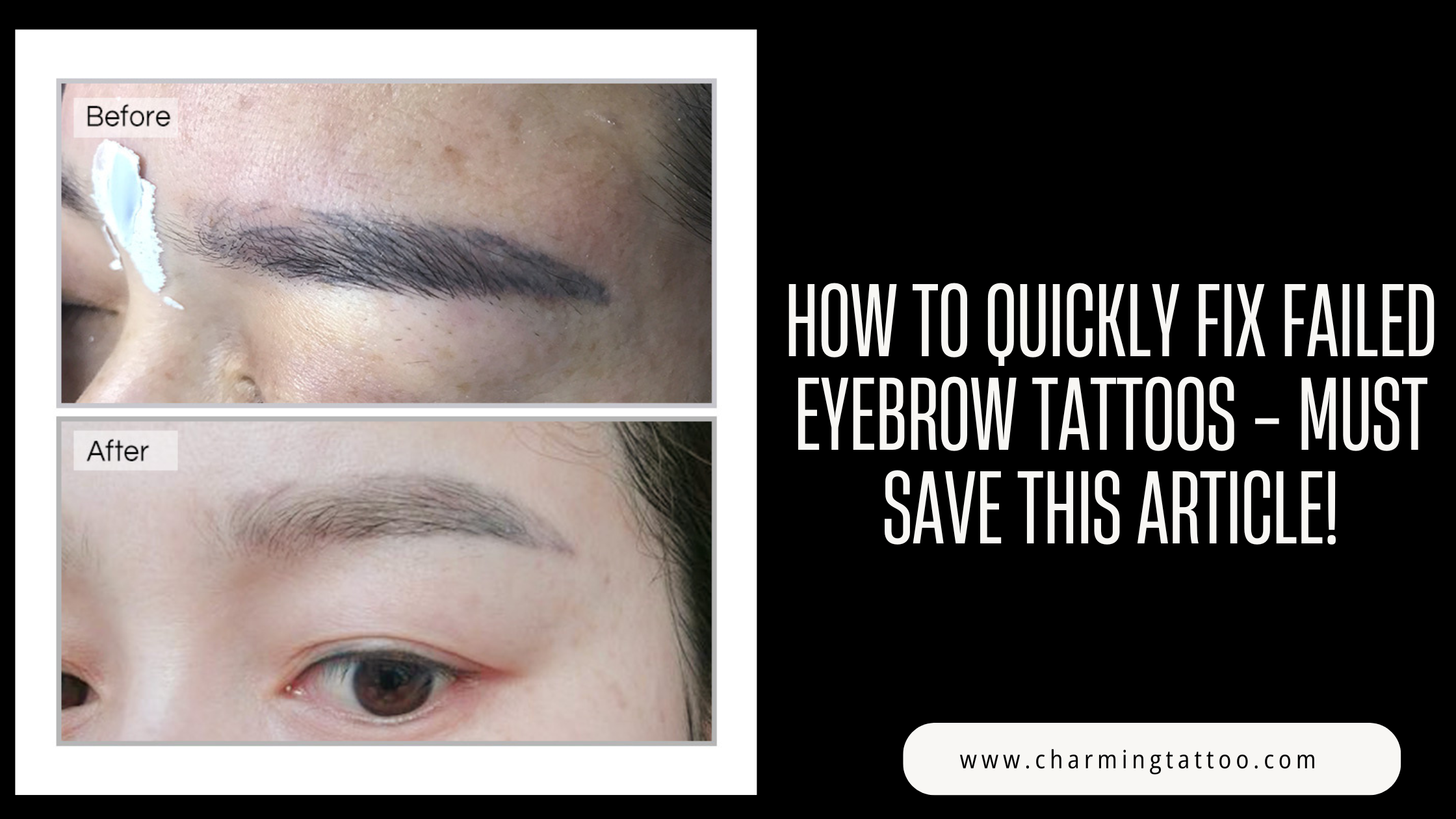 How to Quickly Fix Failed Eyebrow Tattoos - Must Save This Article!