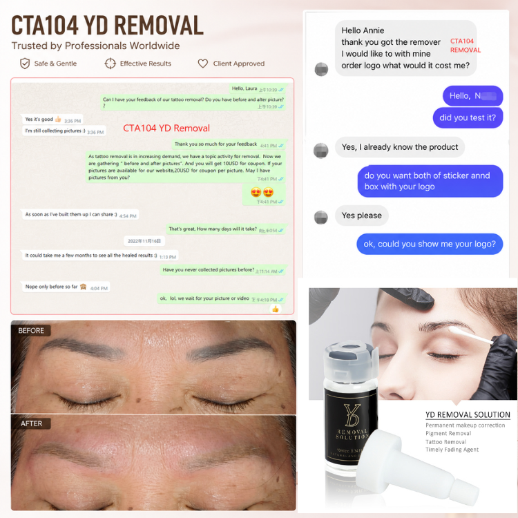 best pmu removal solution