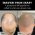 Structured SMP Scalp Micropigmentation Pigment System with Color Correction (Orange & Brown Modifiers) | CharmingTattoo PMU Manufacture