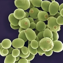 Common concentration methods for separating and purifying fermentation products