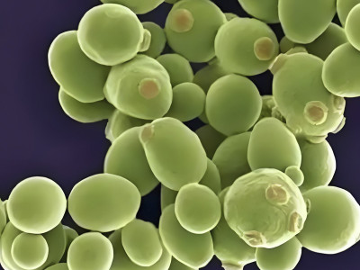 Common concentration methods for separating and purifying fermentation products