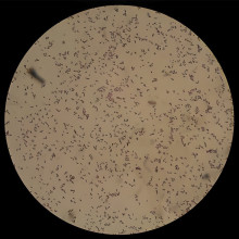 Everything you should know about 100l Bioreactor Pichia pastoris!