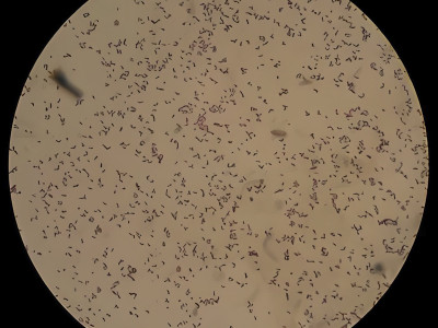 Everything you should know about 100l Bioreactor Pichia pastoris!