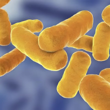 Sorting out industrial fermentation sterilization methods: heat sterilization, radiation sterilization, chemical sterilization, filtration sterilization