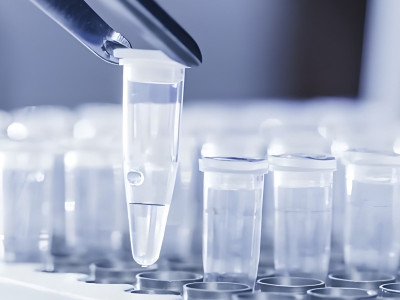 Bioreactor system with metabolic flow analysis as the core
