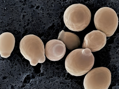 Advantages and disadvantages, production process, commonly used carriers, multiple copies, and purification methods of Pasteur Pichia pastoris