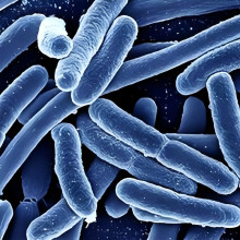 Experience in Escherichia coli fermentation