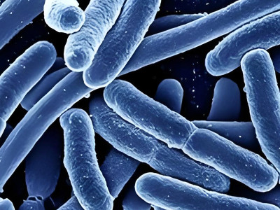 Experience in Escherichia coli fermentation