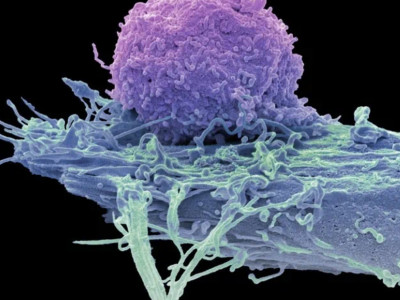 Nature magazine: Seven breakthrough technologies worth paying attention to in 2025, with life sciences occupying four seats!